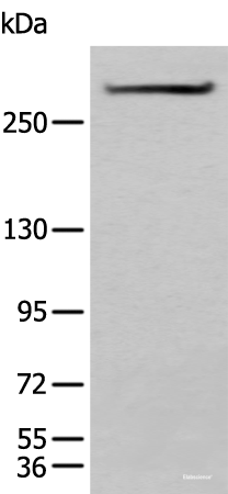Western blot analysis of Mouse heart tissue lysate using SPTA1 Polyclonal Antibody at dilution of 1:550