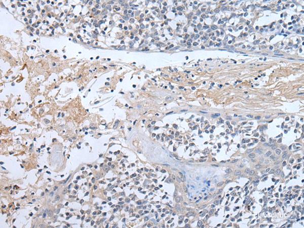Immunohistochemistry of paraffin-embedded Human tonsil tissue using ABR Polyclonal Antibody at dilution of 1:50(×200)