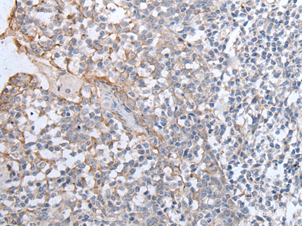 Immunohistochemistry of paraffin-embedded Human tonsil tissue using GPD2 Polyclonal Antibody at dilution of 1:40(×200)