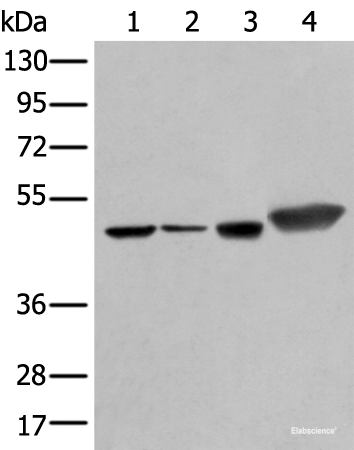 Western blot analysis of Hepg2 A431 Hela and A549 cell lysates using PLAG1 Polyclonal Antibody at dilution of 1:250
