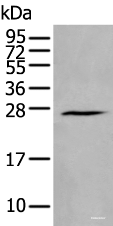 Western blot analysis of Human fetal brain tissue lysate using HAND1 Polyclonal Antibody at dilution of 1:400
