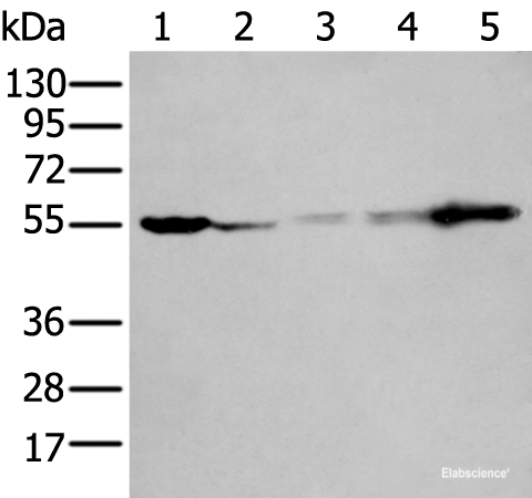 Western blot analysis of 293T A549 A431 Hela and Jurkat cell lysates using PFKFB3 Polyclonal Antibody at dilution of 1:400