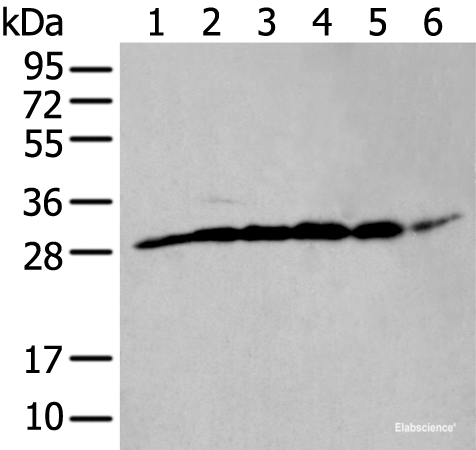 Western blot analysis of PC-3 cell mouse skeletal muscle tissue mouse brain tissue human heart tissue Hela and HEPG2 cell lysates using ETFB Polyclonal Antibody at dilution of 1:400