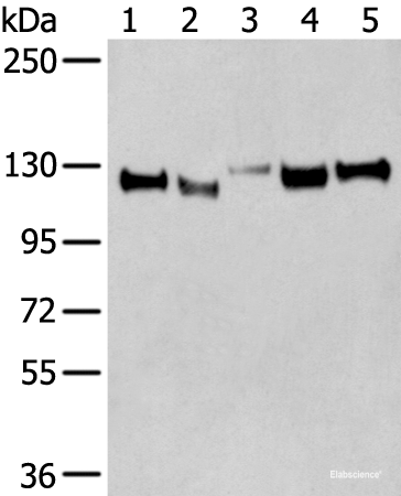 Western blot analysis of Human cerebella tissue Human cerebrum tissue Human fetal brain tissue Mouse brain tissue Rat brain tissue lysates using CNTN1 Polyclonal Antibody at dilution of 1:350