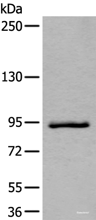 Western blot analysis of Jurkat cell lysate using ZBTB10 Polyclonal Antibody at dilution of 1:800