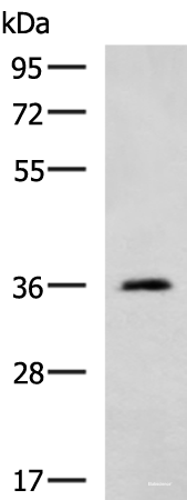 Western blot analysis of Human cerebella tissue lysate using ATP1B2 Polyclonal Antibody at dilution of 1:650