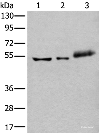 Western blot analysis of Hela cell Mouse kidney tissue and Human colorectal cancer tissue lysates using YY2 Polyclonal Antibody at dilution of 1:800