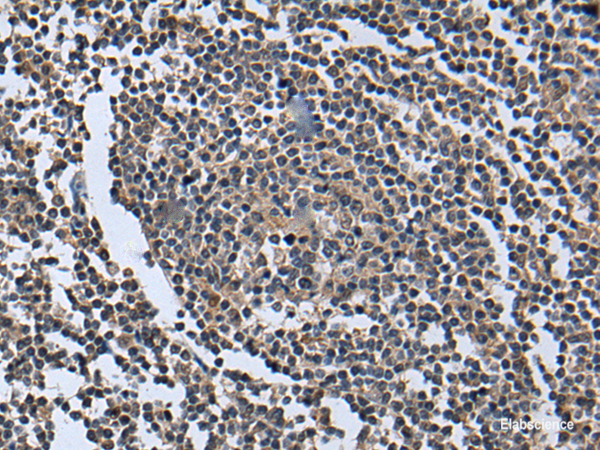 Immunohistochemistry of paraffin-embedded Human tonsil tissue using WNT9B Polyclonal Antibody at dilution of 1:85(×200)