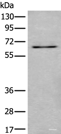 Western blot analysis of SKOV3 cell lysate using UBQLN2 Polyclonal Antibody at dilution of 1:500