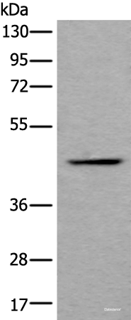 Western blot analysis of Human fetal liver tissue lysate using BMP2 Polyclonal Antibody at dilution of 1:800