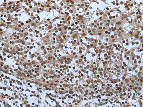 Immunohistochemistry of paraffin-embedded Human tonsil tissue using CELF5 Polyclonal Antibody at dilution of 1:65(×200)