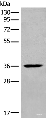 Western blot analysis of Mouse heart tissue lysate using MEDAG Polyclonal Antibody at dilution of 1:700
