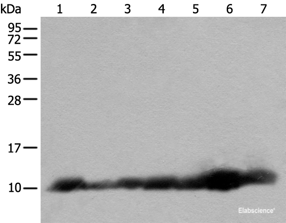 Western blot analysis of 293T and RAW264.7 cell Human fetal brain tissue Jurkat and 231 cell Human heart tissue Hela cell lysates using C14orf2 Polyclonal Antibody at dilution of 1:600