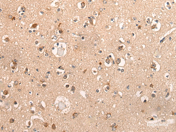 Immunohistochemistry of paraffin-embedded Human brain tissue using DYNAP Polyclonal Antibody at dilution of 1:50(×200)