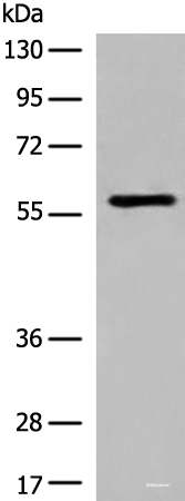 Western blot analysis of Jurkat cell lysate using M1AP Polyclonal Antibody at dilution of 1:600