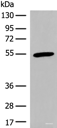 Western blot analysis of Human heart tissue lysate using CIR1 Polyclonal Antibody at dilution of 1:600