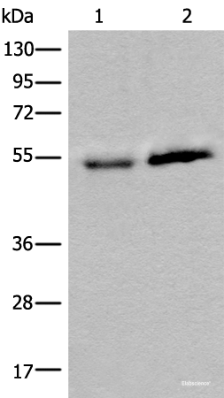 Western blot analysis of Human fetal intestines tissue and Human breast cancer tissue lysates using CCDC85C Polyclonal Antibody at dilution of 1:400