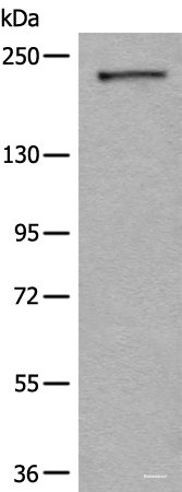 Western blot analysis of A172 cell lysate using CDC42BPA Polyclonal Antibody at dilution of 1:600