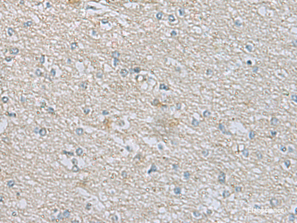 Immunohistochemistry of paraffin-embedded Human brain tissue using CDH12 Polyclonal Antibody at dilution of 1:60(×200)