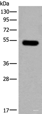 Western blot analysis of Mouse brain tissue lysate using CDKL2 Polyclonal Antibody at dilution of 1:250