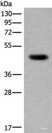 Western blot analysis of Human heart tissue lysate using CDKL4 Polyclonal Antibody at dilution of 1:350