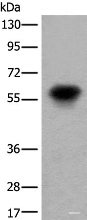 Western blot analysis of Human fetal brain tissue lysate using CDT1 Polyclonal Antibody at dilution of 1:550