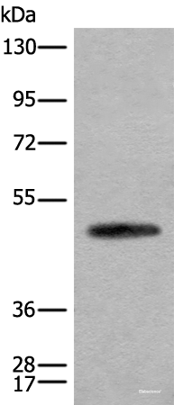 Western blot analysis of Human cerebella tissue lysate using CADM2 Polyclonal Antibody at dilution of 1:2000