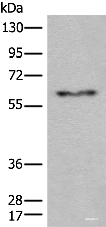 Western blot analysis of Human fetal liver tissue lysate using CES2 Polyclonal Antibody at dilution of 1:600