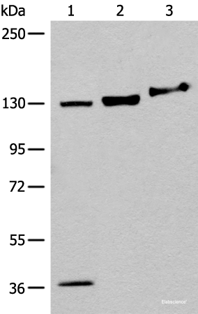 Western blot analysis of 293T cell Mouse brain tissue lysates using EPHA6 Polyclonal Antibody at dilution of 1:500