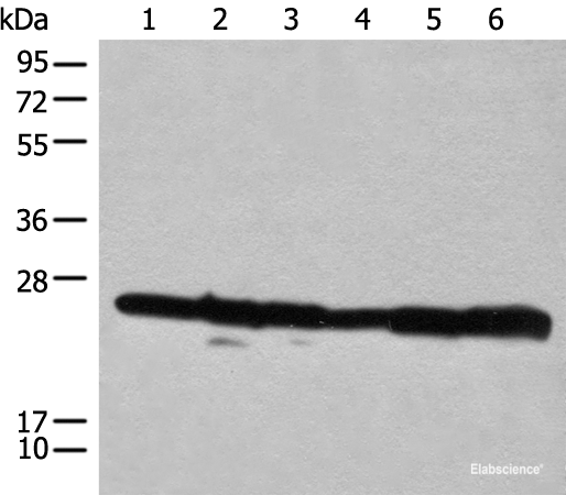 Western blot analysis of 293T cell lysates using RPL14 Polyclonal Antibody at dilution of 1:300