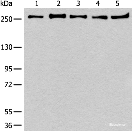 Western blot analysis of 293T K562 Raji Hela and NIH/3T3 cell lysates using PRPF8 Polyclonal Antibody at dilution of 1:600