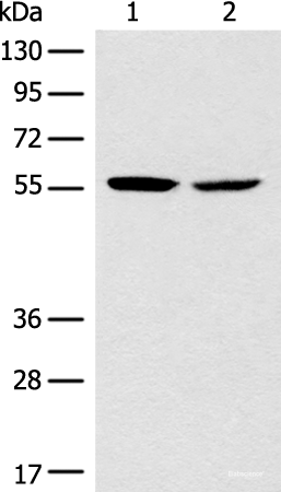 Western blot analysis of Mouse brain tissue NIH/3T3 cell lysates using CORO2B Polyclonal Antibody at dilution of 1:1000