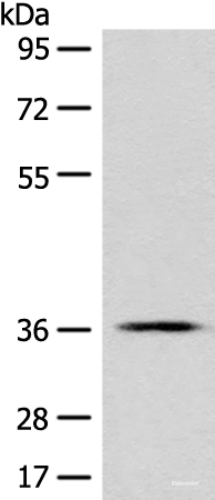 Western blot analysis of PC-3 cell lysate using GPR55 Polyclonal Antibody at dilution of 1:500