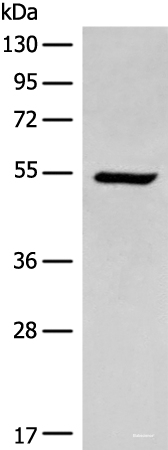 Western blot analysis of HEPG2 cell lysate using ACD Polyclonal Antibody at dilution of 1:400
