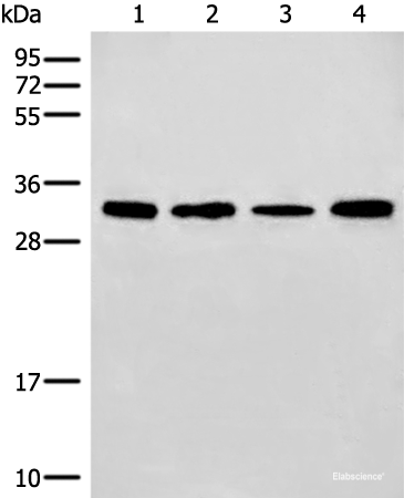 Western blot analysis of 293T and NIH/3T3 cell Mouse liver tissue lysates using ERCC1 Polyclonal Antibody at dilution of 1:600