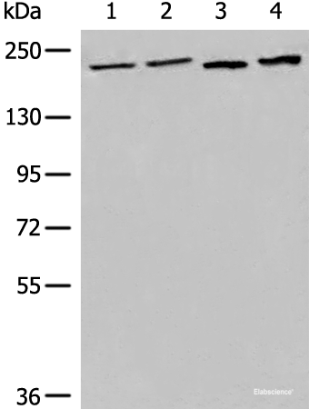Western blot analysis of 293T cell Human metastatic malignant melanoma tissue lysates using EEA1 Polyclonal Antibody at dilution of 1:700