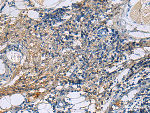 Immunohistochemistry of paraffin-embedded Human tonsil tissue using PROC Polyclonal Antibody at dilution of 1:100(×200)