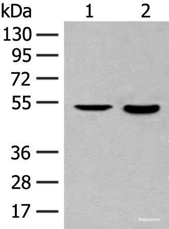 Western blot analysis of Jurkat cell and Human fetal brain tissue lysates using IL7R Polyclonal Antibody at dilution of 1:800