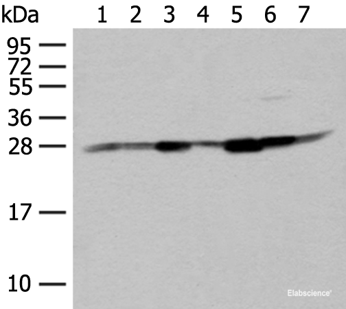 Western blot analysis of Hela HT-29 and HEPG2 cell Human liver tissue Human fetal liver tissue Mouse liver tissue and Human fetal brain tissue lysates using NIPSNAP2 Polyclonal Antibody at dilution of 1:400