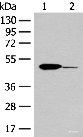 Western blot analysis of Mouse heart tissue and K562 cell lysates using ACOD1 Polyclonal Antibody at dilution of 1:400