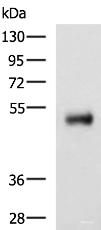 Western blot analysis of Human colorectal cancer tissue lysate using METTL17 Polyclonal Antibody at dilution of 1:800