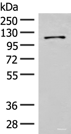 Western blot analysis of Hela cell lysate using FANCB Polyclonal Antibody at dilution of 1:550