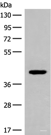 Western blot analysis of 293T cell lysate using FCGRT Polyclonal Antibody at dilution of 1:500