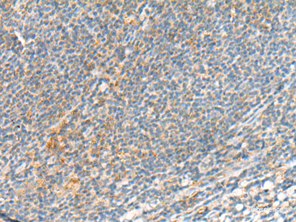 Immunohistochemistry of paraffin-embedded Human tonsil tissue using TSHB Polyclonal Antibody at dilution of 1:95(×200)
