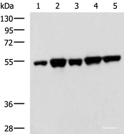 Western blot analysis of PC3 K562 HepG2 Hela A172 cell lysates using FKBP5 Polyclonal Antibody at dilution of 1:600