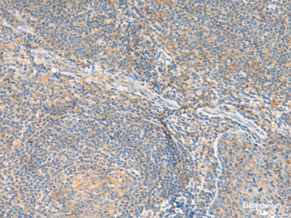 Immunohistochemistry of paraffin-embedded Human tonsil tissue using RNF207 Polyclonal Antibody at dilution of 1:80(×200)