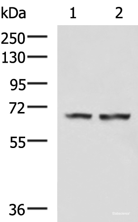 Western blot analysis of Human cerebella tissue Human cerebrum tissue lysates using FNBP1L Polyclonal Antibody at dilution of 1:750
