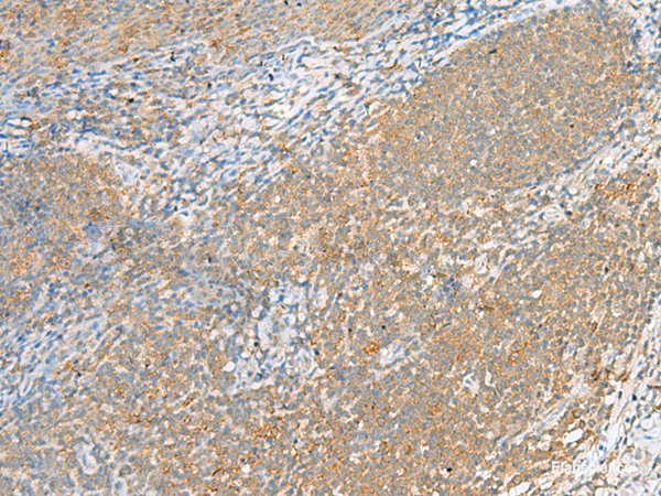 Immunohistochemistry of paraffin-embedded Human tonsil tissue using FOLR1 Polyclonal Antibody at dilution of 1:80(×200)