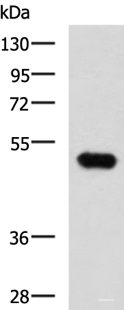 Western blot analysis of Mouse kidney tissue lysate using FOXQ1 Polyclonal Antibody at dilution of 1:750