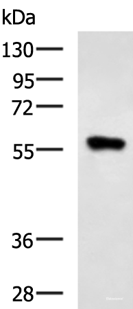 Western blot analysis of Raji cell lysate using SQSTM1 Polyclonal Antibody at dilution of 1:900